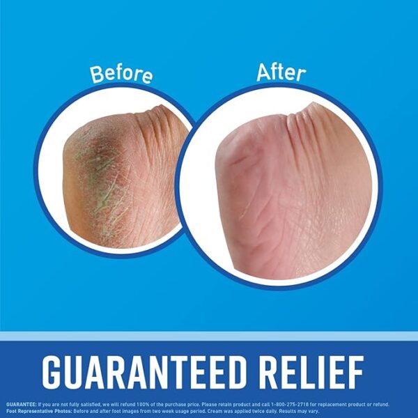 O'Keeffe's for Healthy Feet Foot Cream; Guaranteed Relief for Extremely - Image 4