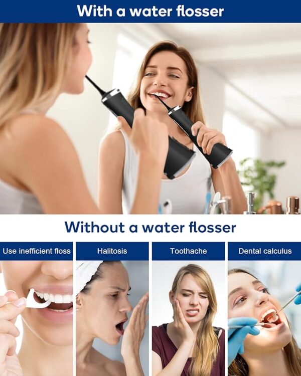 MySmile LP211 Cordless Advanced Water Flossers for Teeth - Image 5